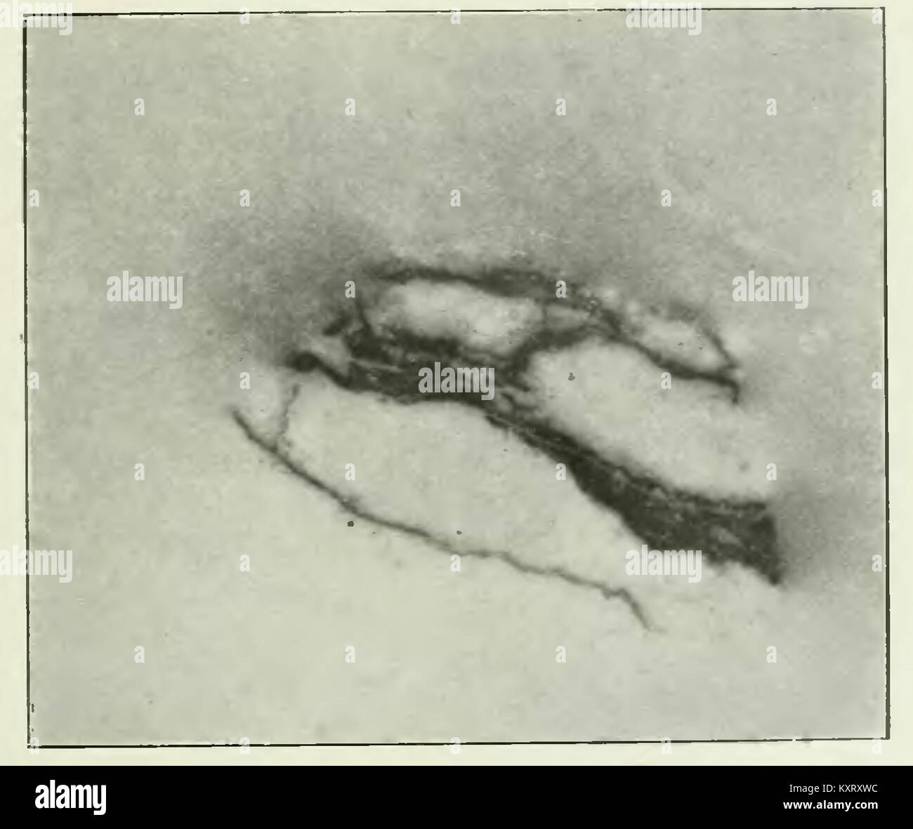 Radioactivité curie hi-res stock photography and images - Alamy