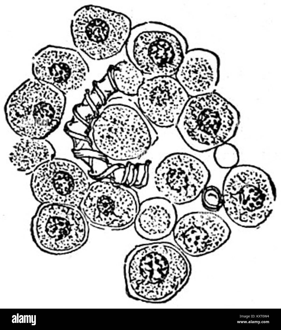 EB1911 Mycetozoa - Trichia varia - sporangium (2) Stock Photo