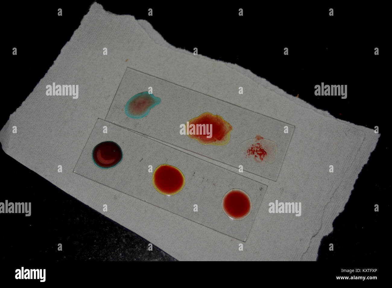 Blood Sample on Slide to observe blood group Stock Photo Alamy