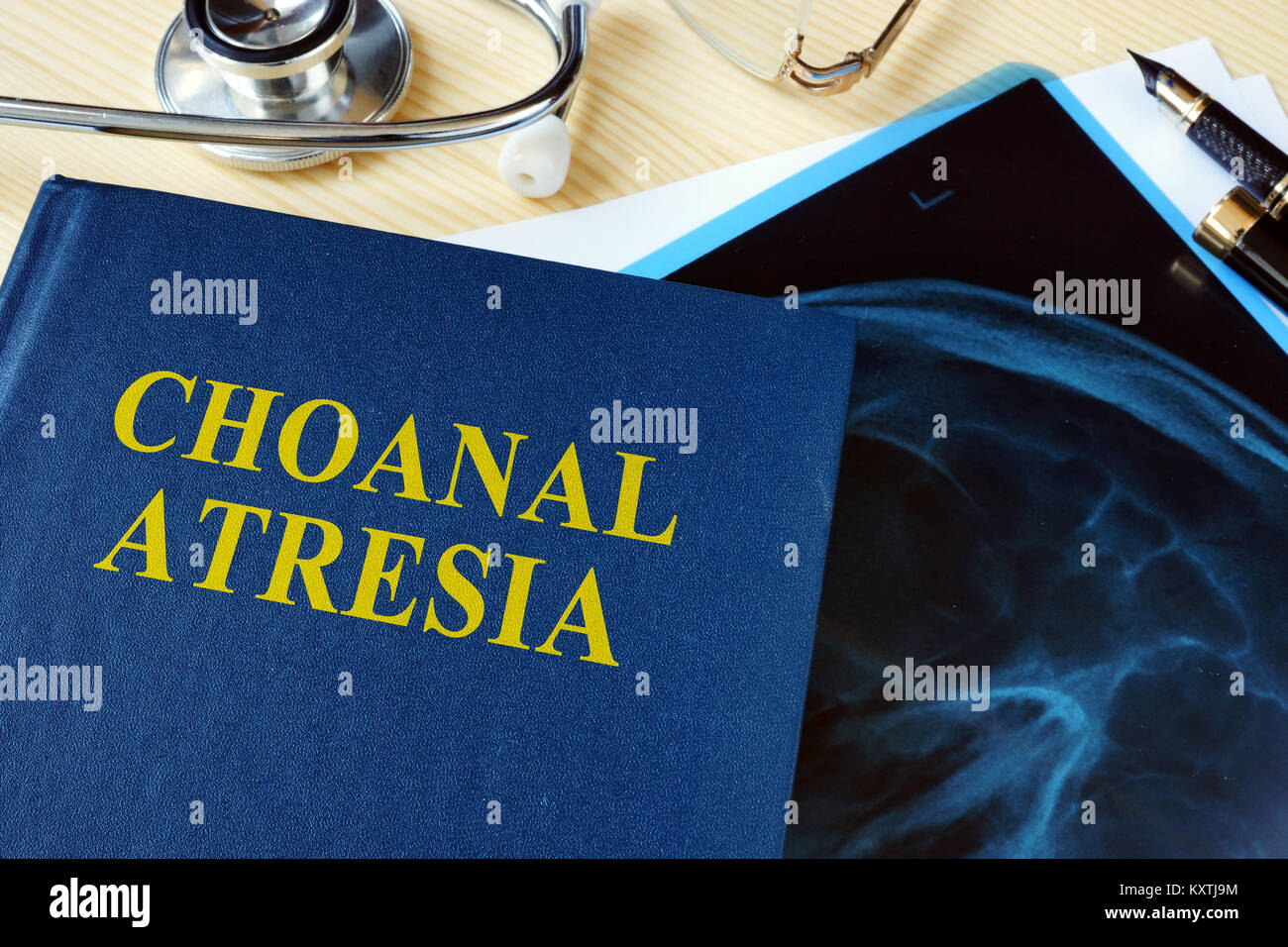 Book about Choanal Atresia on a hospital desk. Stock Photo