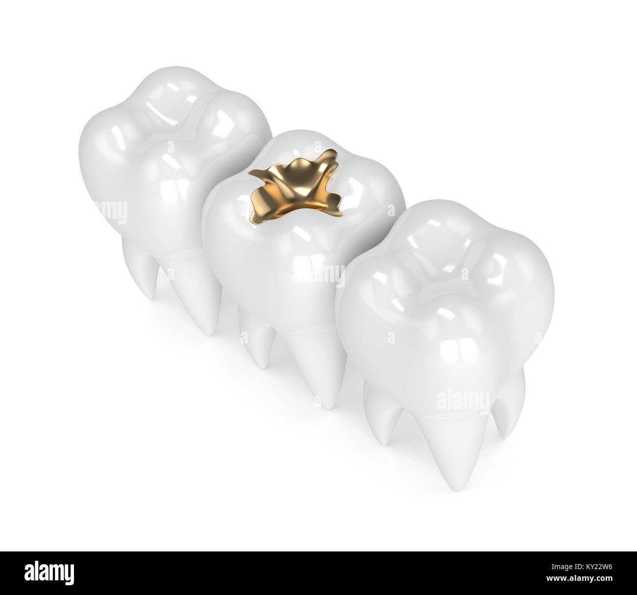 render of teeth 3d render of teeth with dental gold filling in row Stock Photo - Alamy