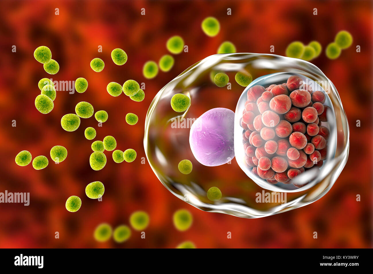 Chlamydia infection. Computer illustration of a cell infected with Chlamydia trachomatis bacteria. Elementary bodies (EBs, small green spheres), the non-replicating infectious form of the bacteria are seen outside the host cell. EBs infect the cell and are transformed into reticulate bodies (RB), which are replicating form. RBs are seen as a group of small red spheres near the nucleus (purple) of the cell. Chlamydia is a sexually transmitted infection that can go undetected causing infertility. It also causes the eye disease trachoma, which can lead to blindness. Stock Photo