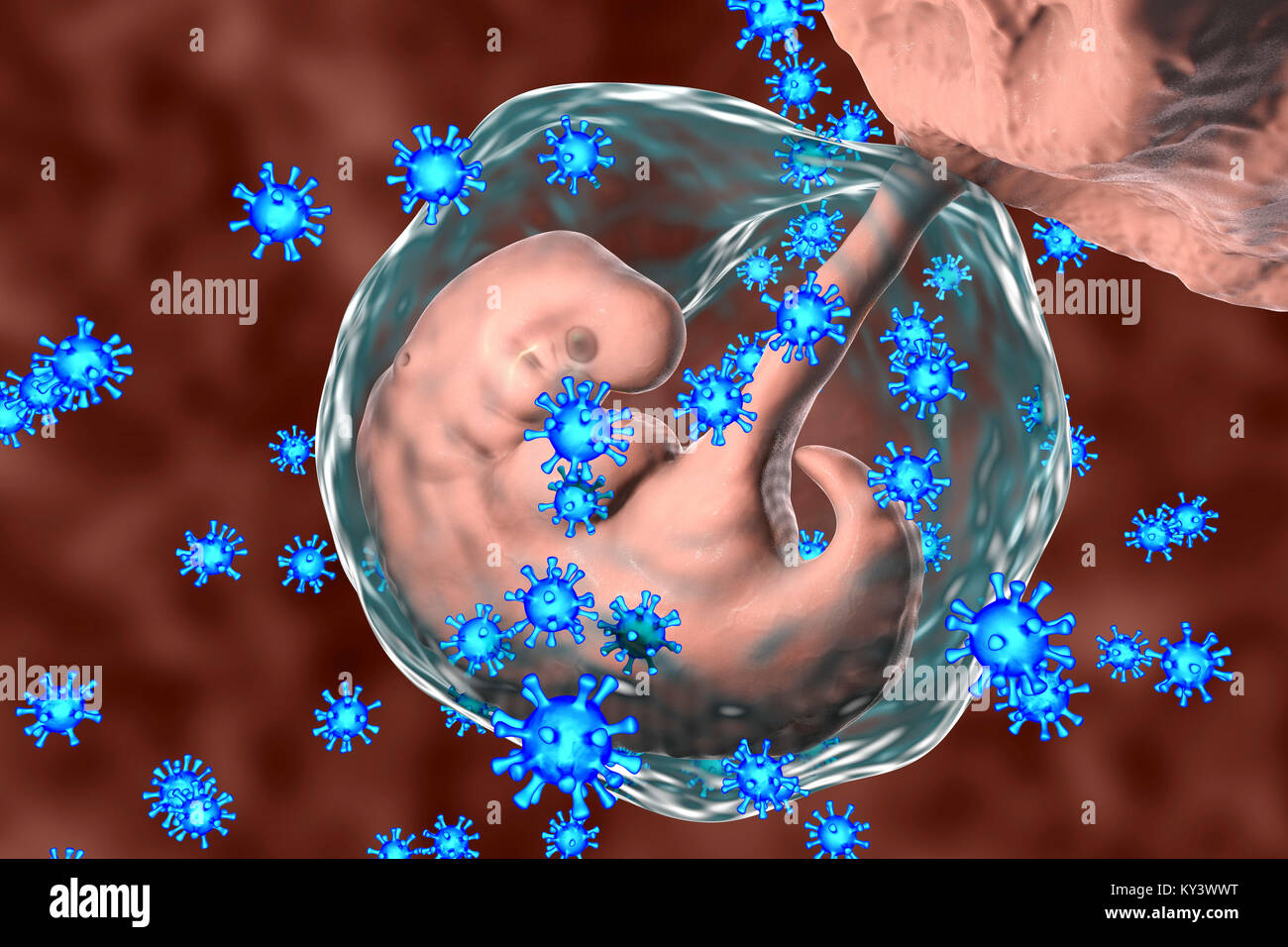 Viruses infecting human embryo, conceptual illustration. The embryo is 4 weeks old. Many viruses cause fetal abnormalities or stillbirth. For example, rubella, herpes and cytomegalovirus cause different fetal pathology, whilst fetal measles infection usually leads to stillbirth. Stock Photo