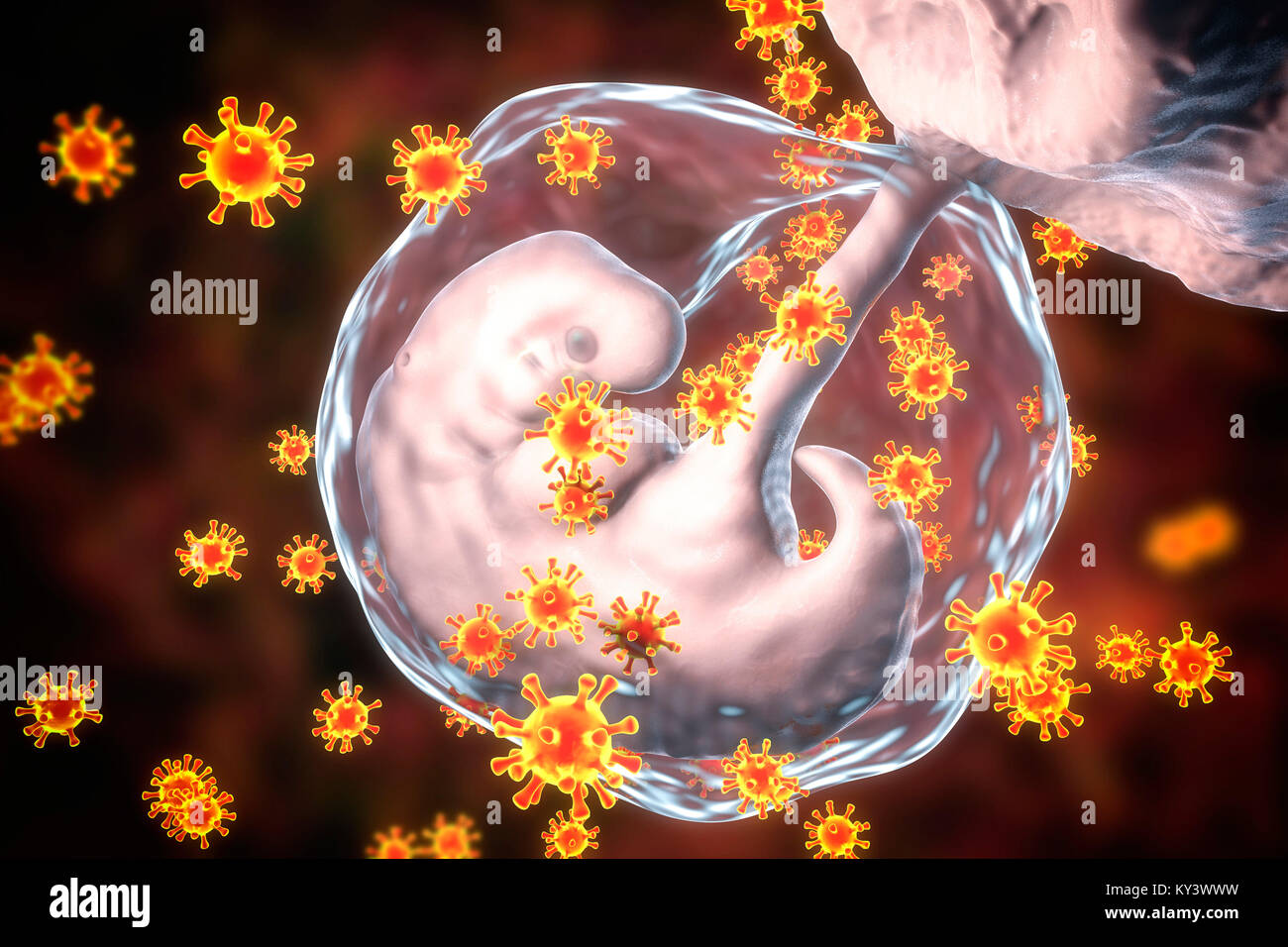 Viruses infecting human embryo, conceptual illustration. The embryo is 4 weeks old. Many viruses cause fetal abnormalities or stillbirth. For example, rubella, herpes and cytomegalovirus cause different fetal pathology, whilst fetal measles infection usually leads to stillbirth. Stock Photo