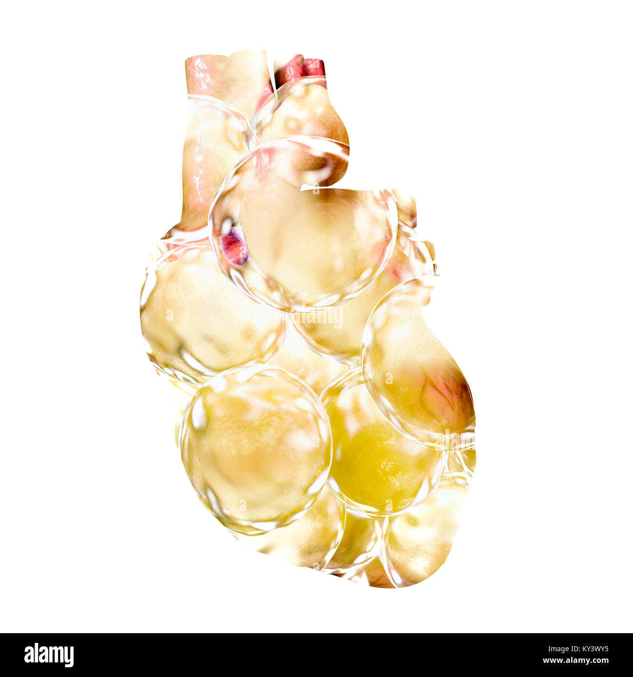 Fatty heart. Conceptual illustration showing a heart made of fat cells. Stock Photo