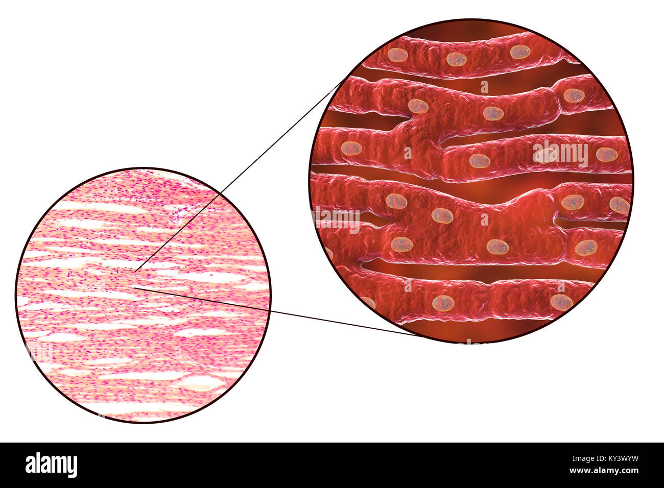 Heart muscle structure, computer illustration and light micrograph. Heart muscle is composed of spindle-shaped cells grouped in irregular bundles. Boundaries between individual cells are faintly visible here. Each cell contains one nucleus, visible as a dark stained spot. Cardiac muscle is a specialised muscle tissue that can contract regularly and continuously without tiring. Stock Photo