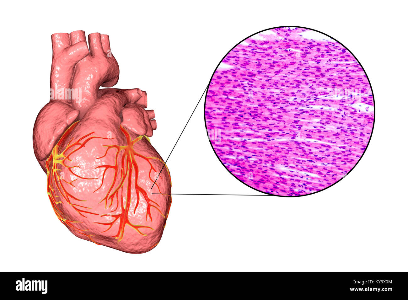 Computer illustration of a human heart and light micrograph of heart muscle. Heart muscle is composed of spindle-shaped cells grouped in irregular bundles. Boundaries between individual cells are faintly visible here. Each cell contains one nucleus, visible as a dark stained spot. Cardiac muscle is a specialised muscle tissue that can contract regularly and continuously without tiring. Stock Photo