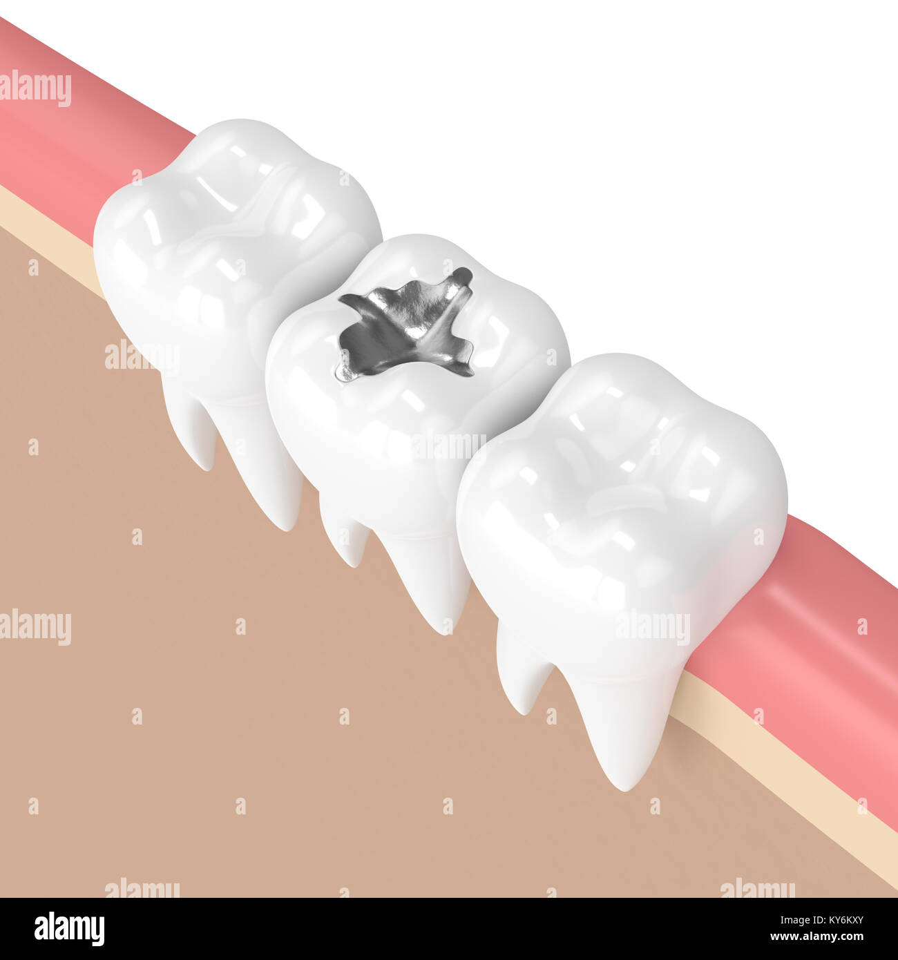 Restorative dental care hires stock photography and images Alamy