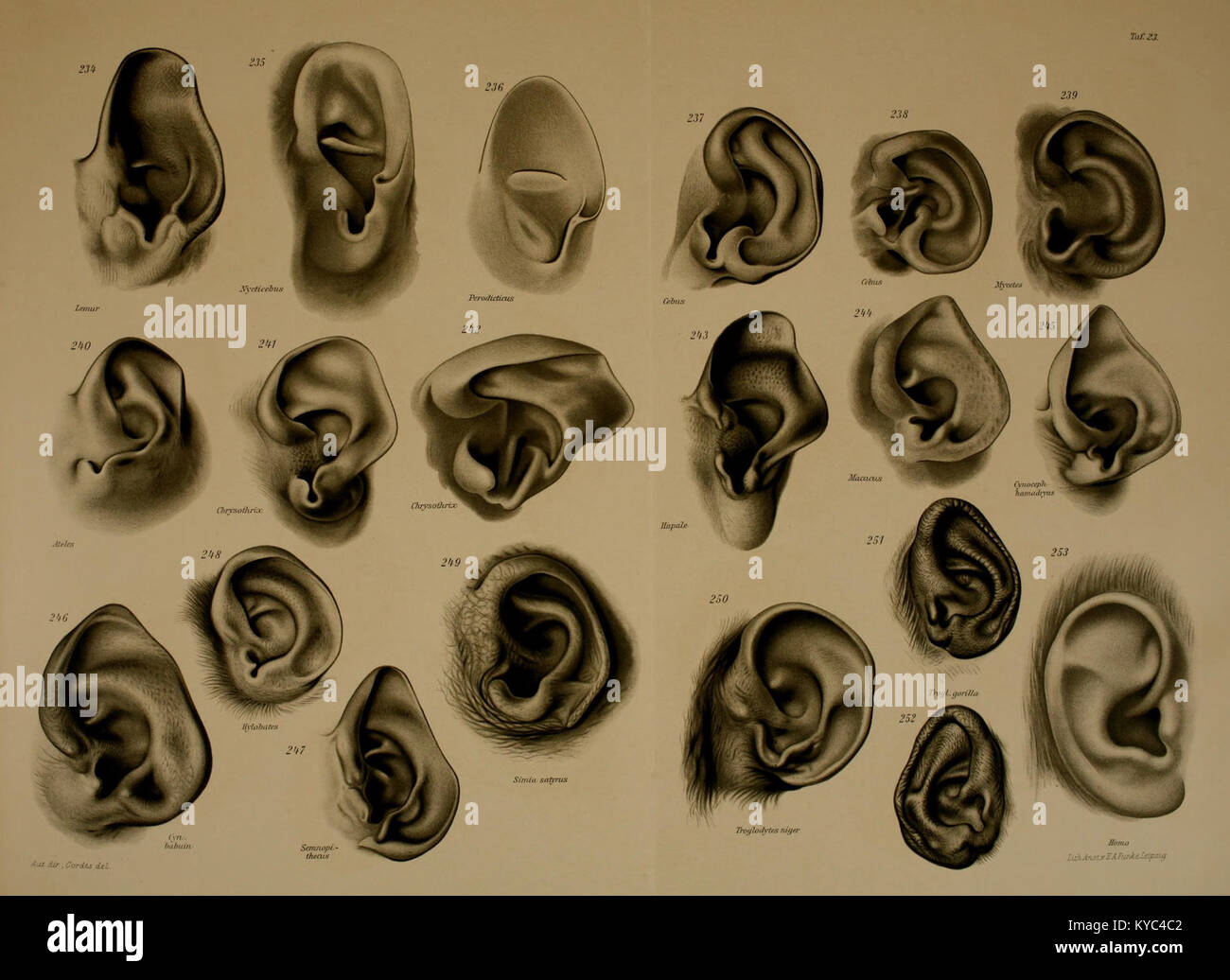An anatomical illustration of the ear cartilage and external ear of ...