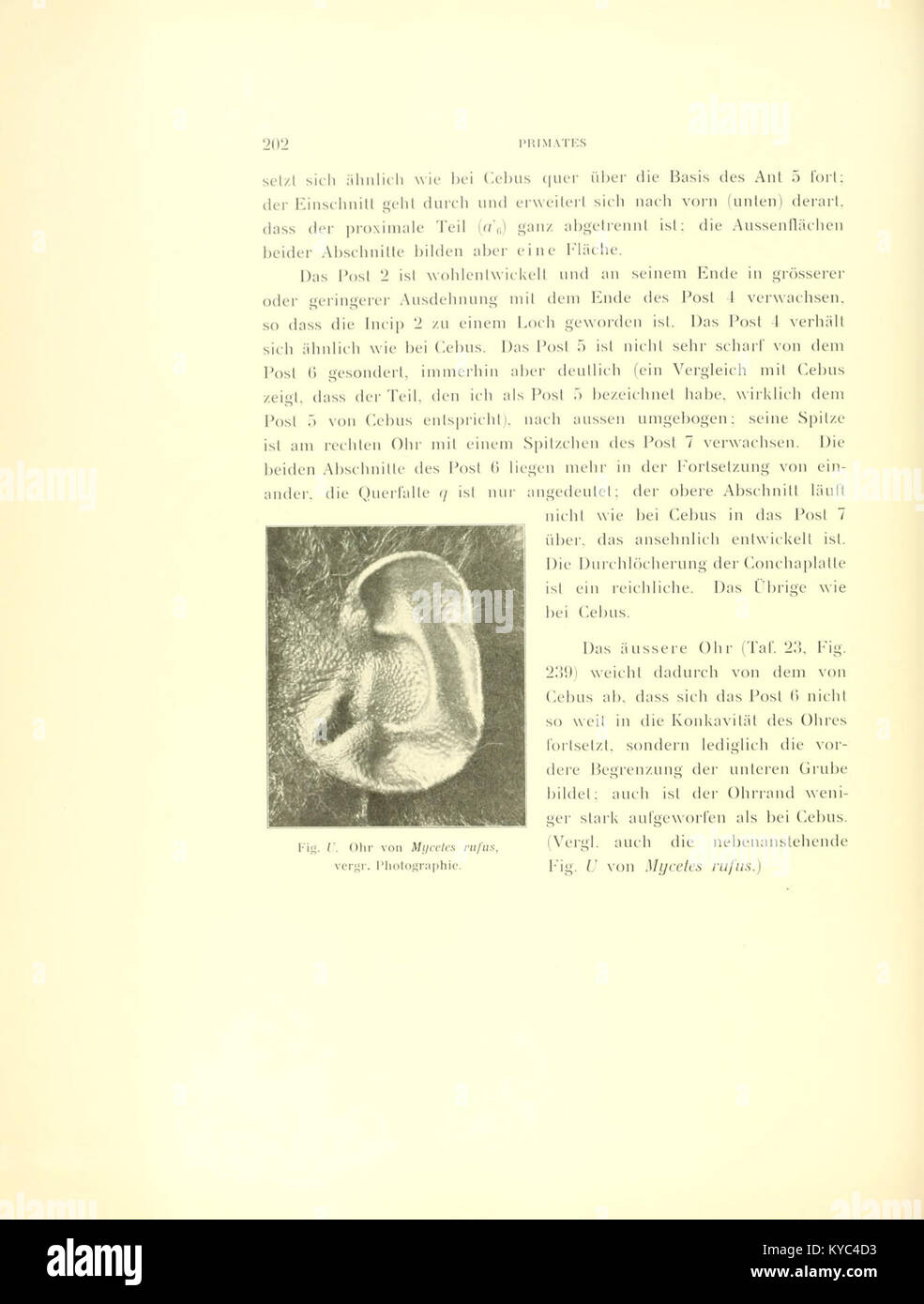 Shell Of An Ear Scientific illustration showing the cartilage and external ear of a ...