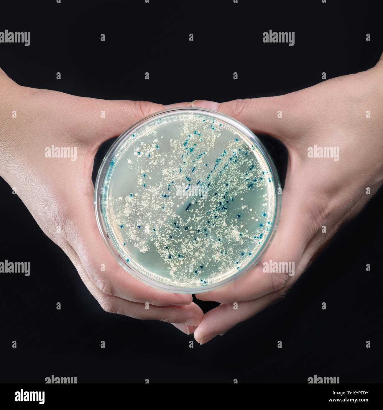 Hands holding agar plate with bacterial colonies for plasmid vector cloning Stock Photo