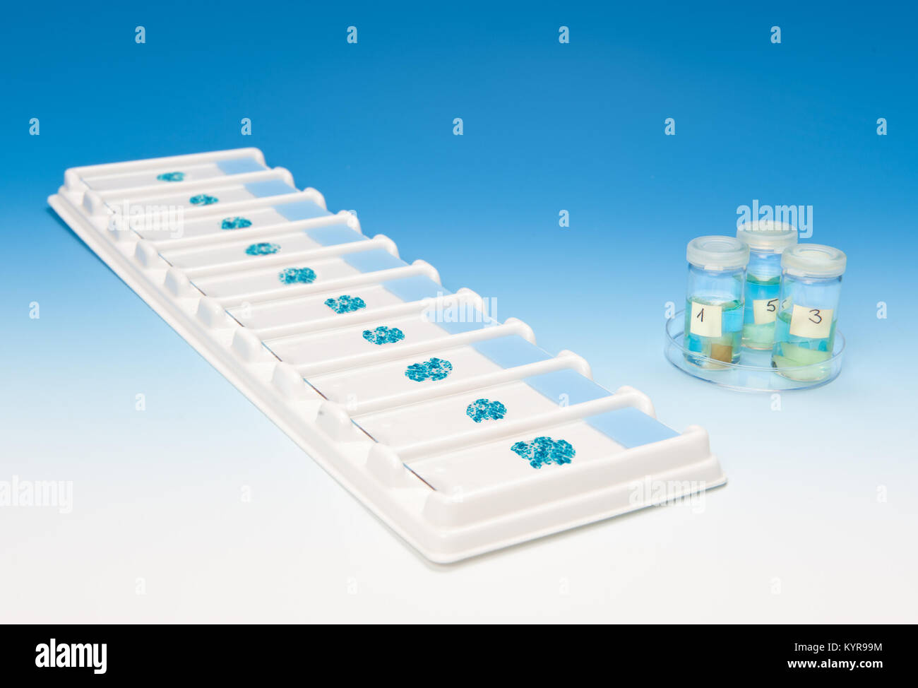Patient tissue samples on a tray and in tubes on blue gradient background Stock Photo