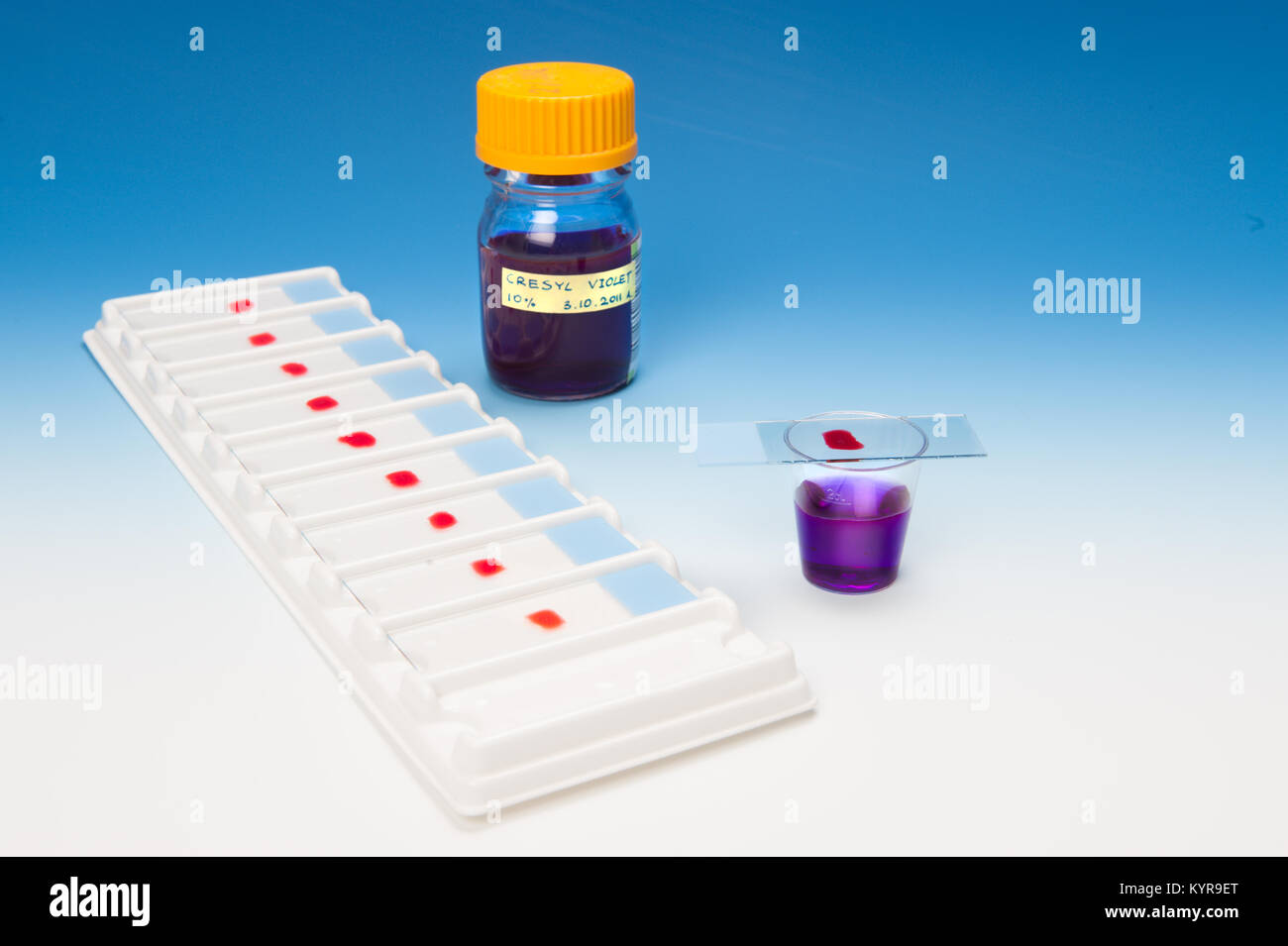 Staining Samples Patient microscopic samples and staining solutions Stock Photo - Alamy