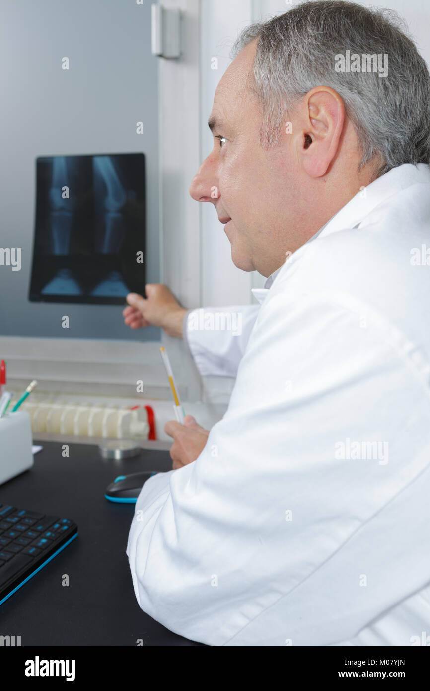 Doctor x ray feet hires stock photography and images Alamy