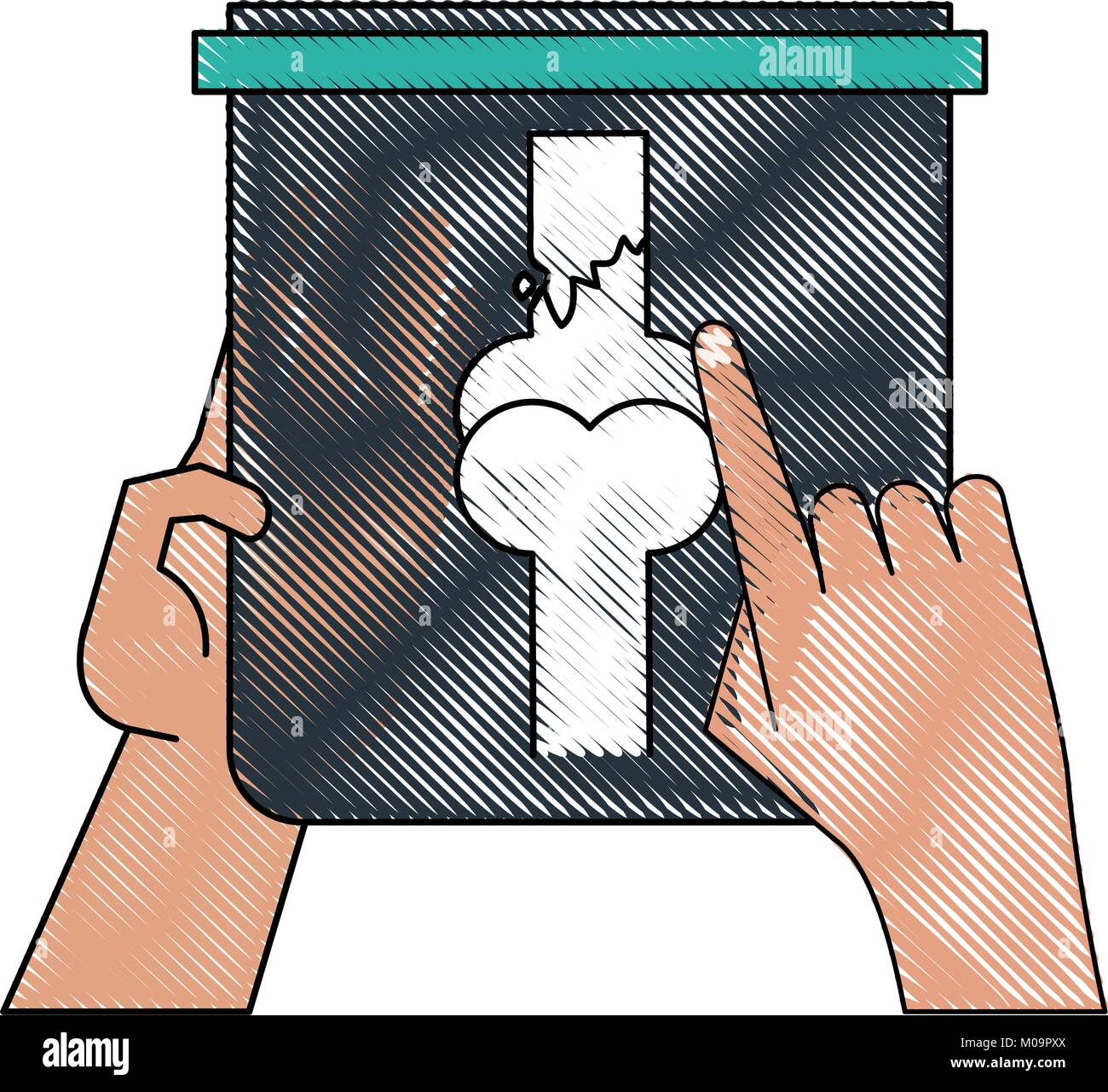 Hand holding X ray bones Stock Vector Image & Art - Alamy