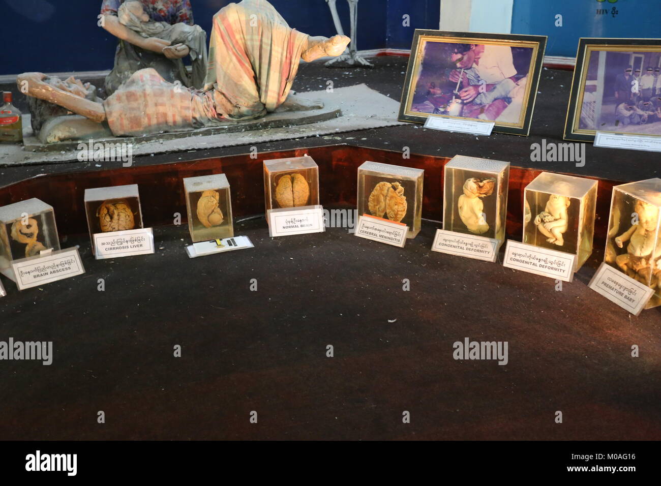 The Drug Elimination Museum in Yangon is filled with displays warning of the dangers and risks of drug addiction. Stock Photo