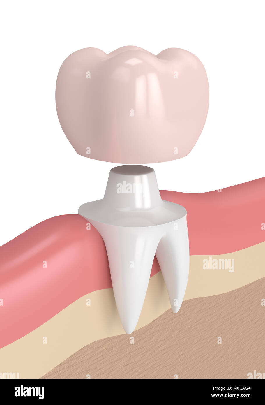 3d render of tooth with dental crown filling in gums Stock Photo Alamy