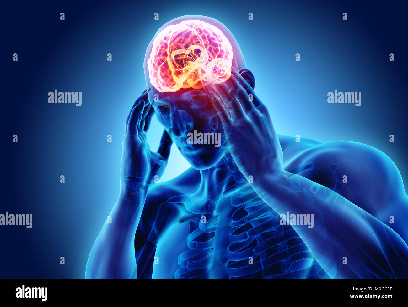3d illustration of headache human, xray medical concept Stock Photo