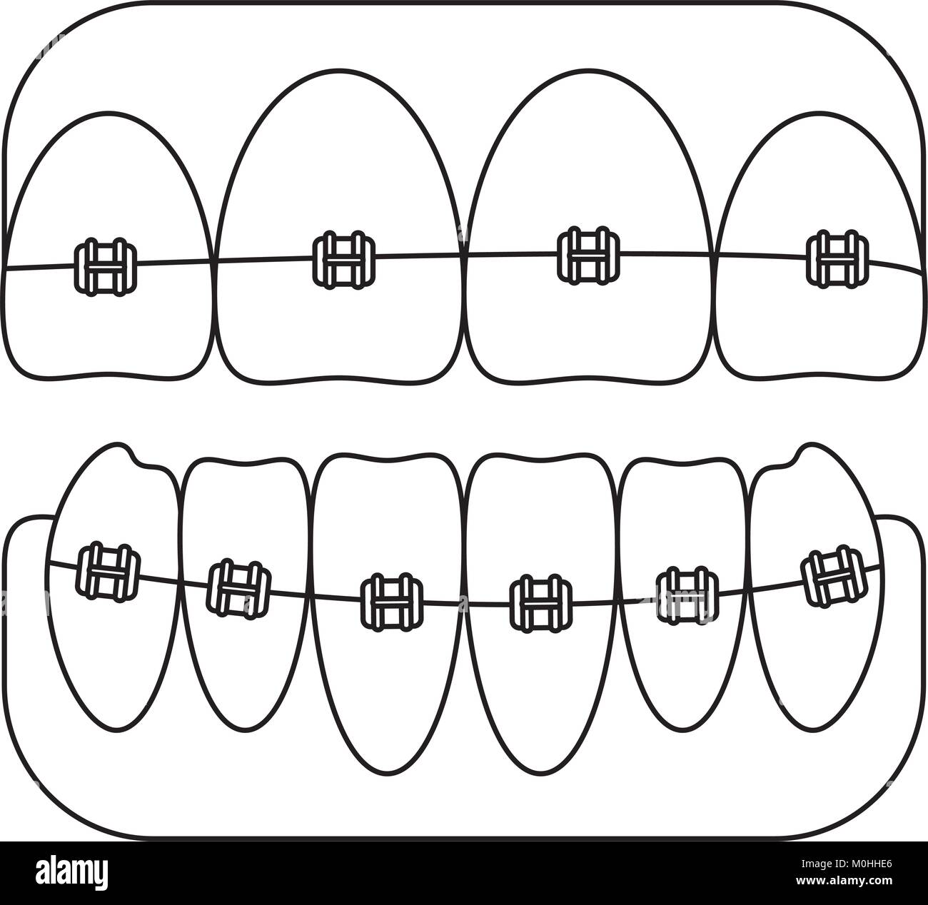 teeth with brackets icon Stock Vector Image & Art - Alamy