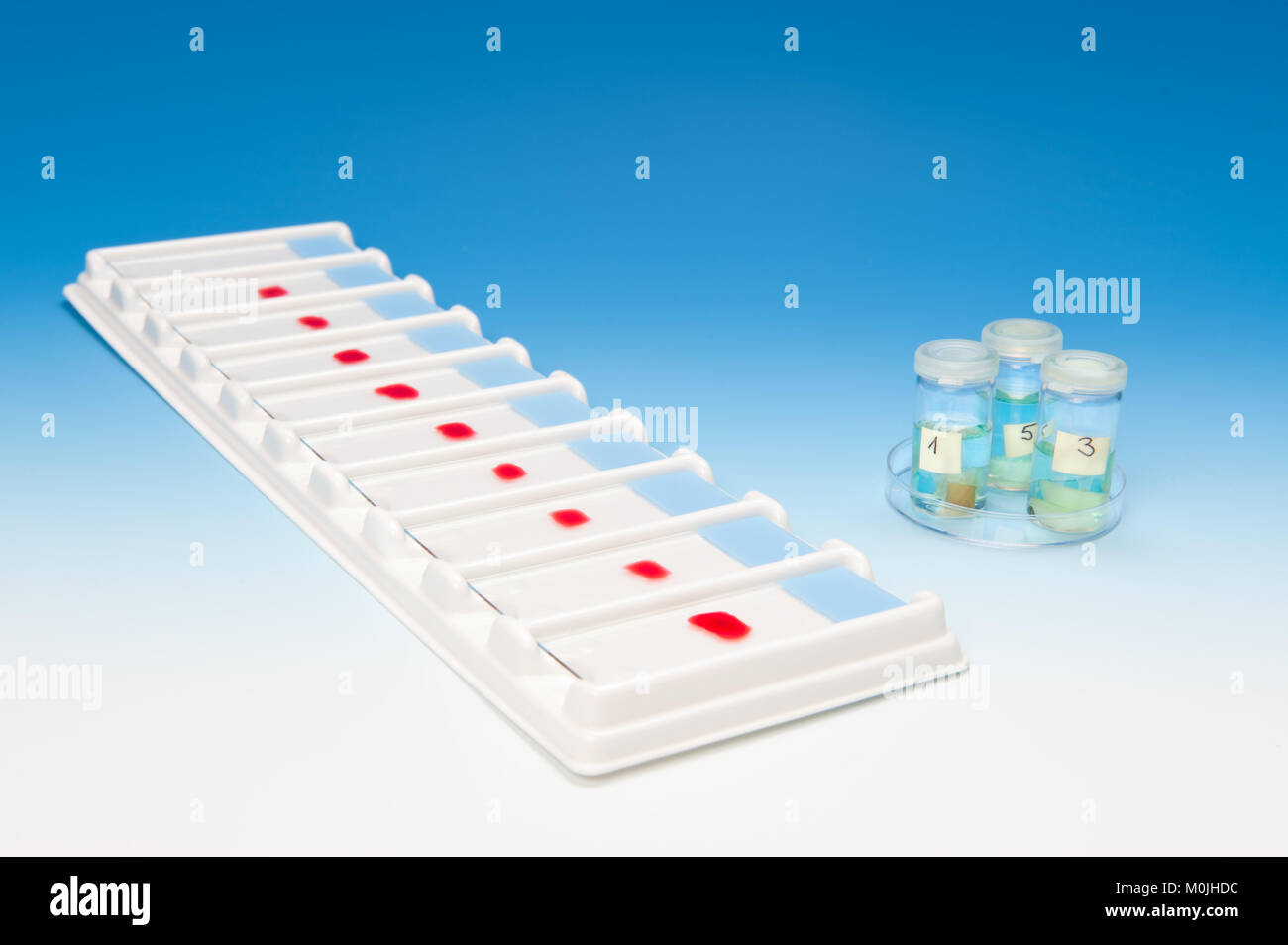 Array of blood samples for microscopy and biopsy tissue on blue gradient background Stock Photo