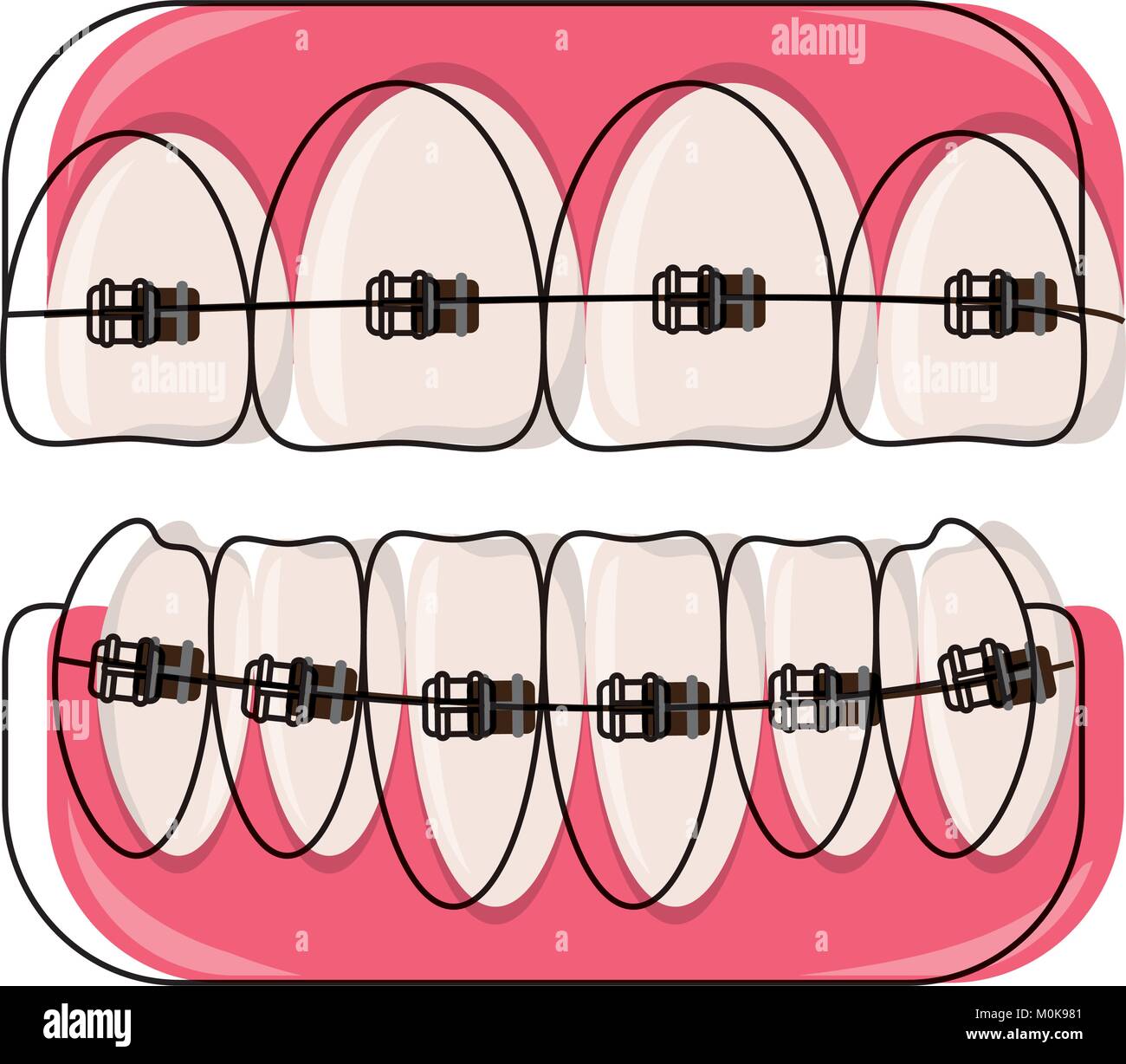 teeth with brackets icon Stock Vector Image & Art - Alamy