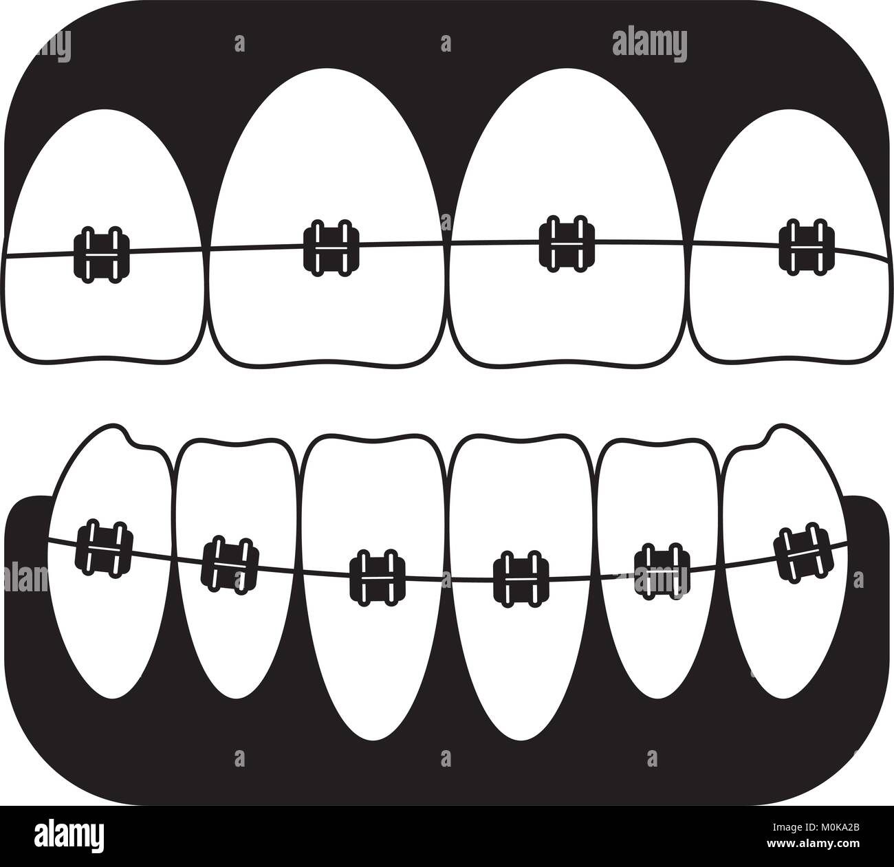 teeth with brackets icon Stock Vector Image & Art - Alamy