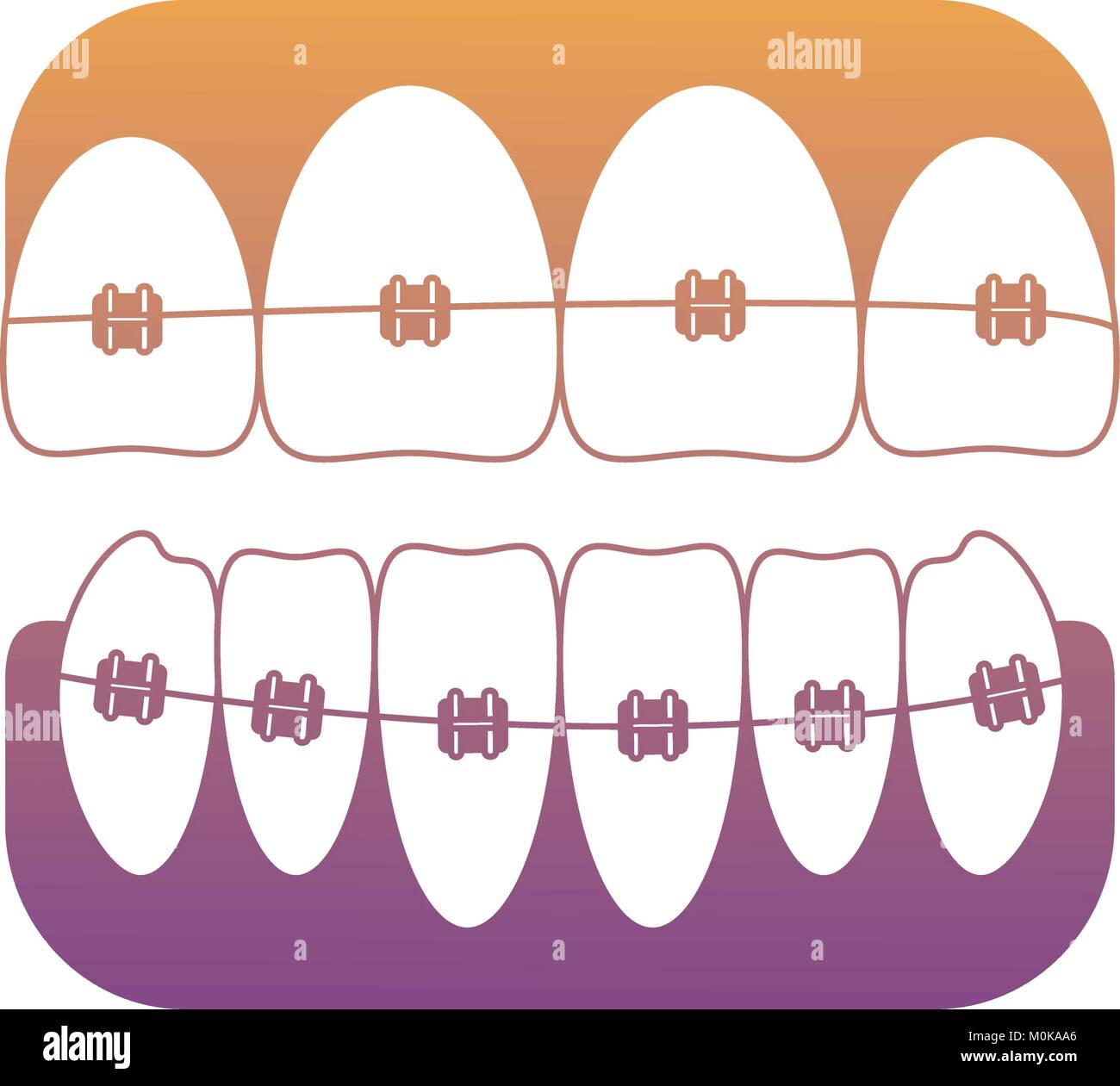 teeth with brackets icon Stock Vector Image & Art - Alamy