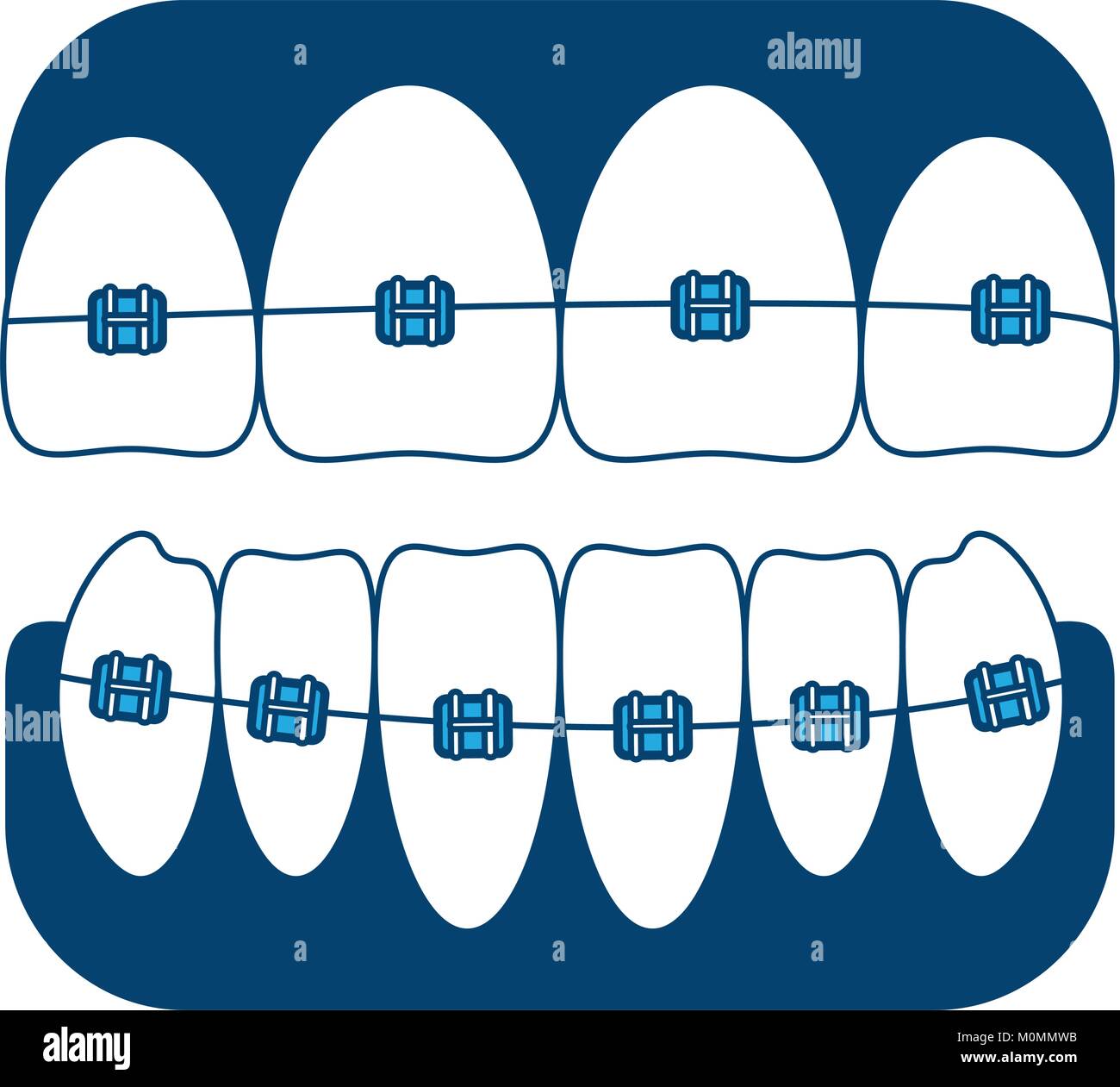teeth with brackets icon Stock Vector Image & Art - Alamy