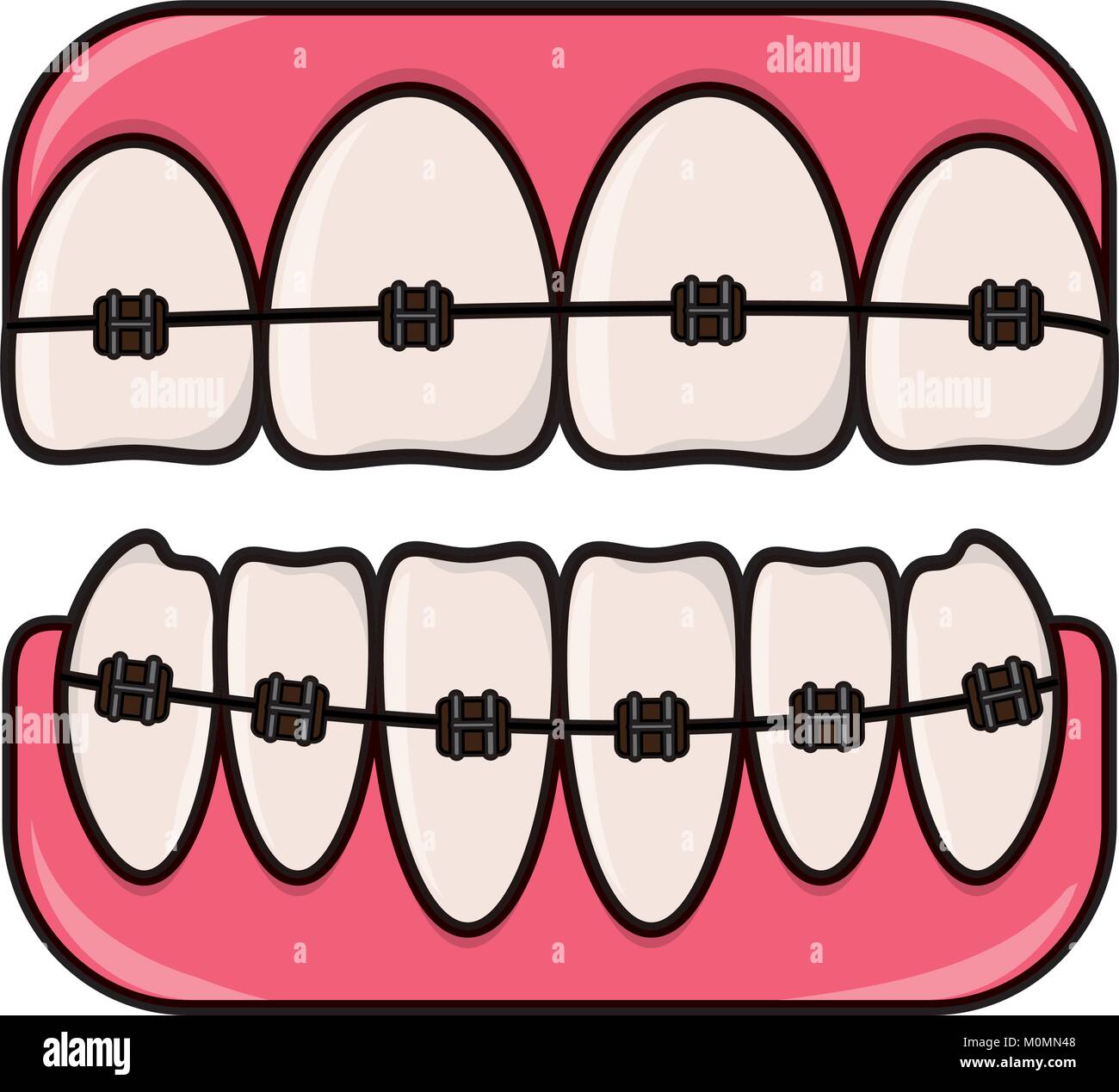 teeth with brackets icon Stock Vector Image & Art - Alamy