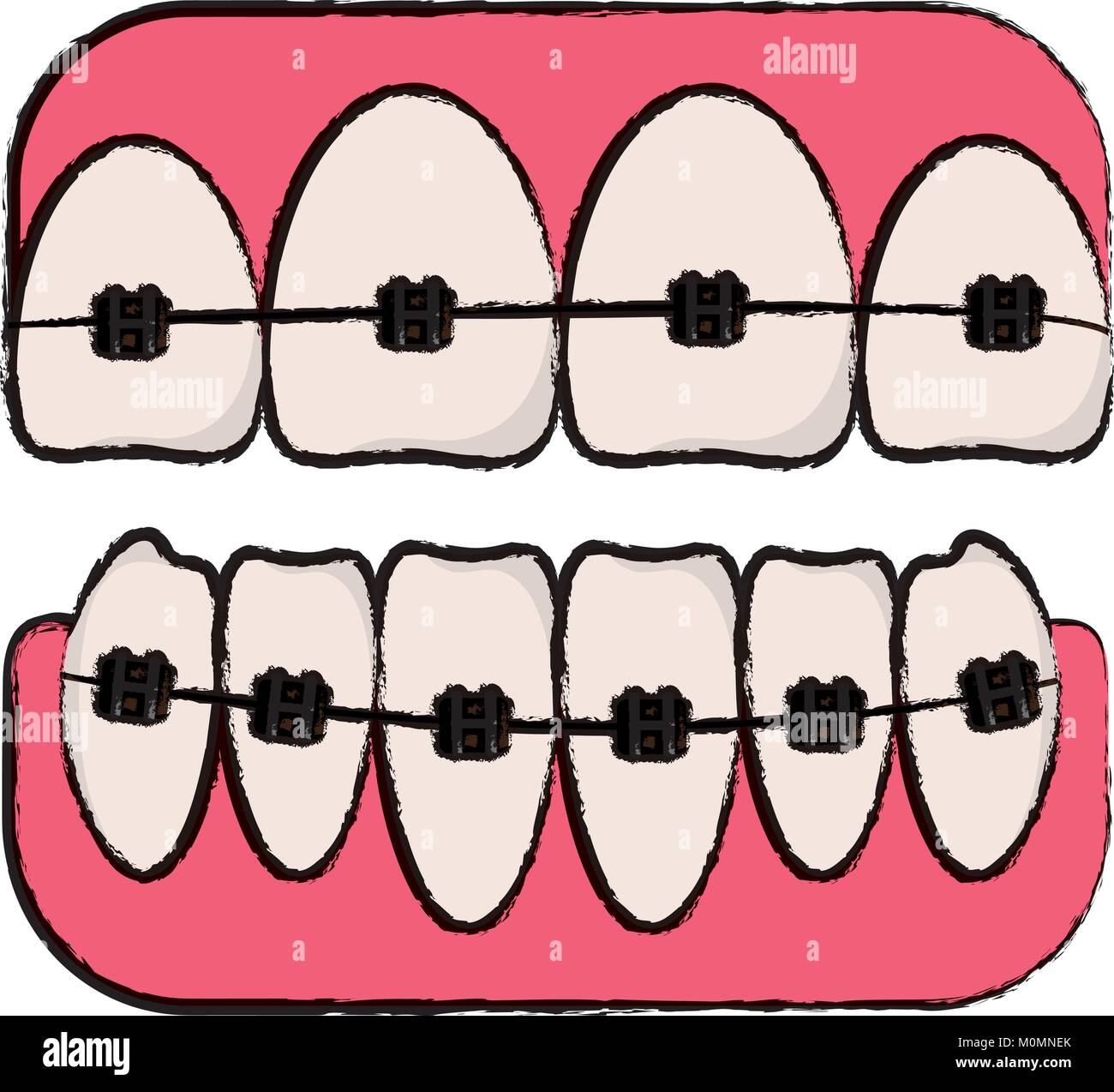 teeth with brackets icon Stock Vector Image & Art - Alamy