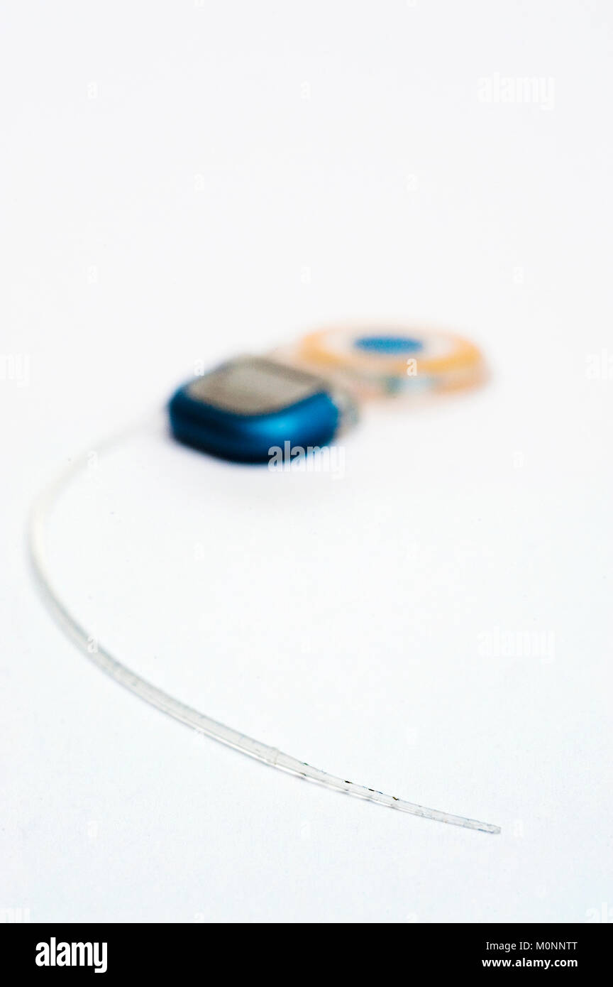 Close-up of the electrode array of a  multichannel cochlear implant. Stock Photo