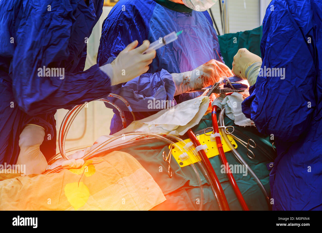 Surgeon hands are tying a knot during the open heart procedure chest during heart surgery Stock