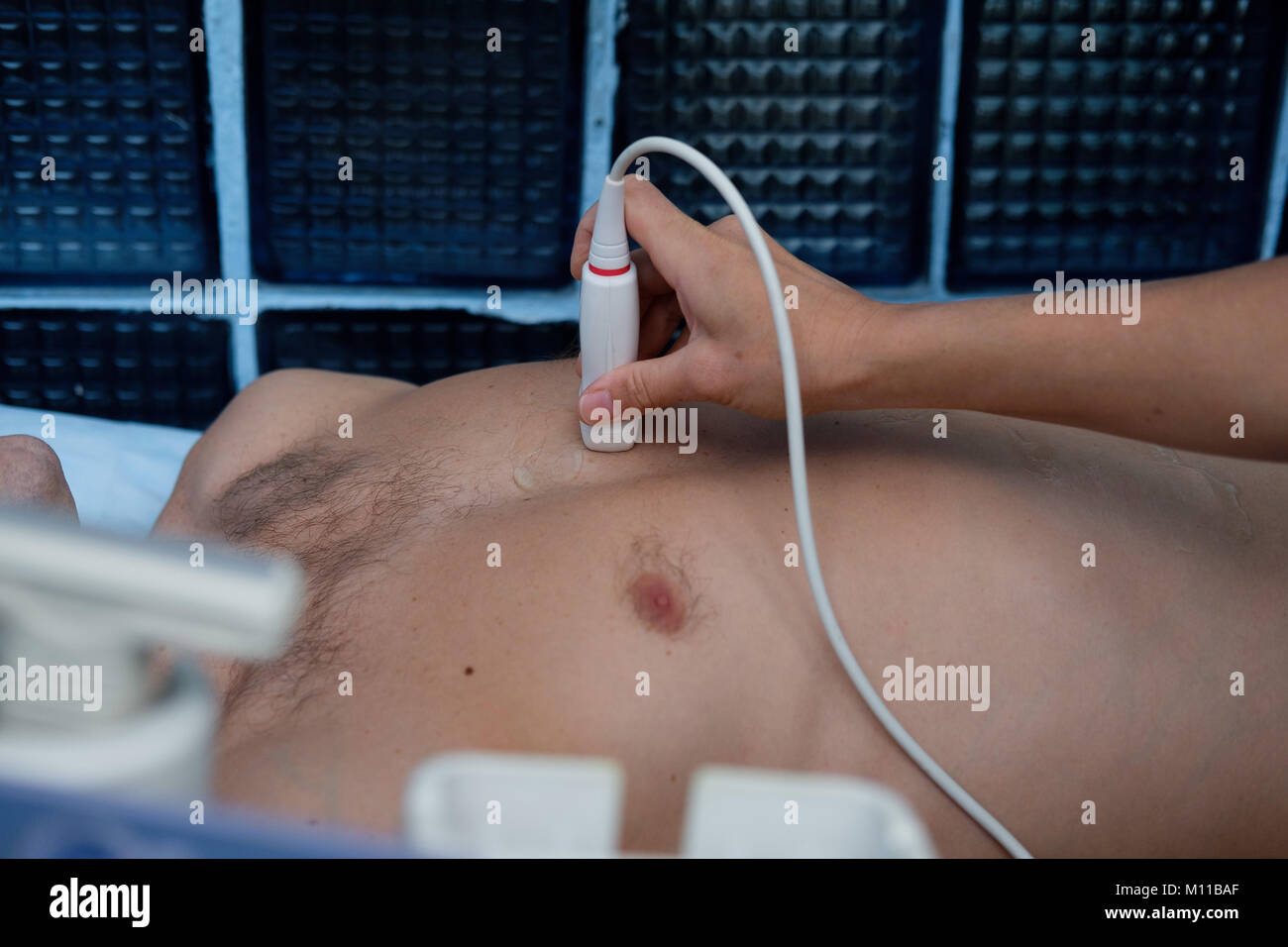 Ультразвуковое Исследование Молочных Желез Цена К31