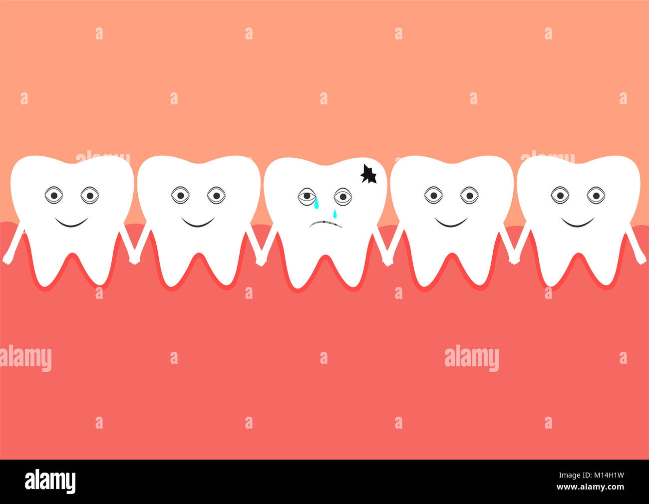 A number of teeth in the oral cavity, one of which is affacted by