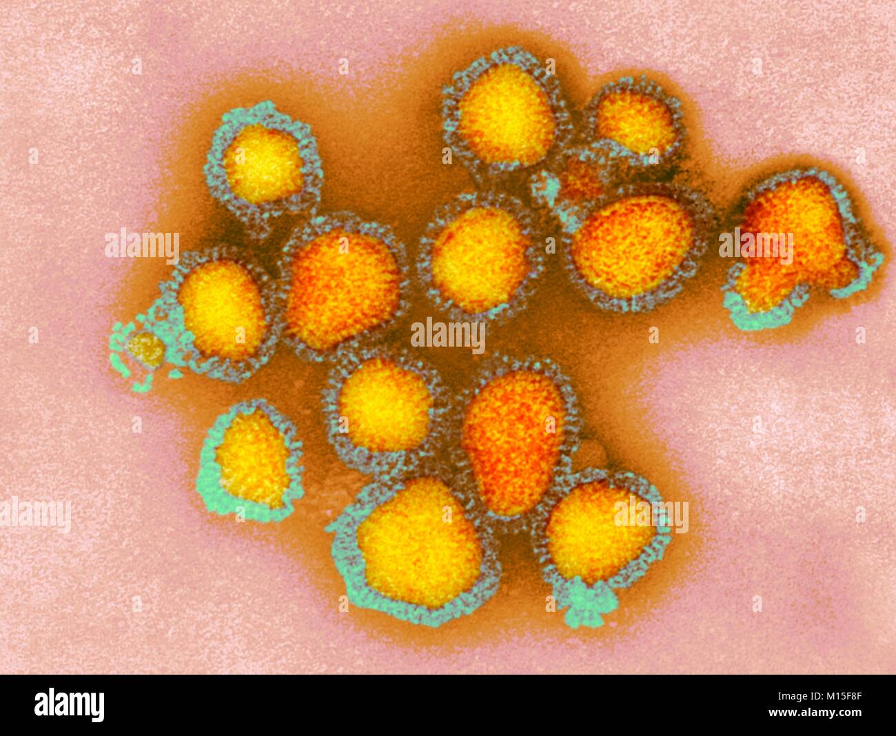 H3N2 influenza virus particles, coloured transmission electron micrograph (TEM). Each virus consists of a nucleocapsid (protein coat) that surrounds a core of RNA (ribonucleic acid) genetic material. Surrounding the nucleocapsid is a lipid envelope that contains the glycoprotein spikes haemagglutinin (H) and neuraminidase (N). These viruses were part of the Hong Kong Flu pandemic of 1968-1969 that killed approximately one million worldwide. H3N2 viruses are able to infect birds and mammals as well as humans. Stock Photo