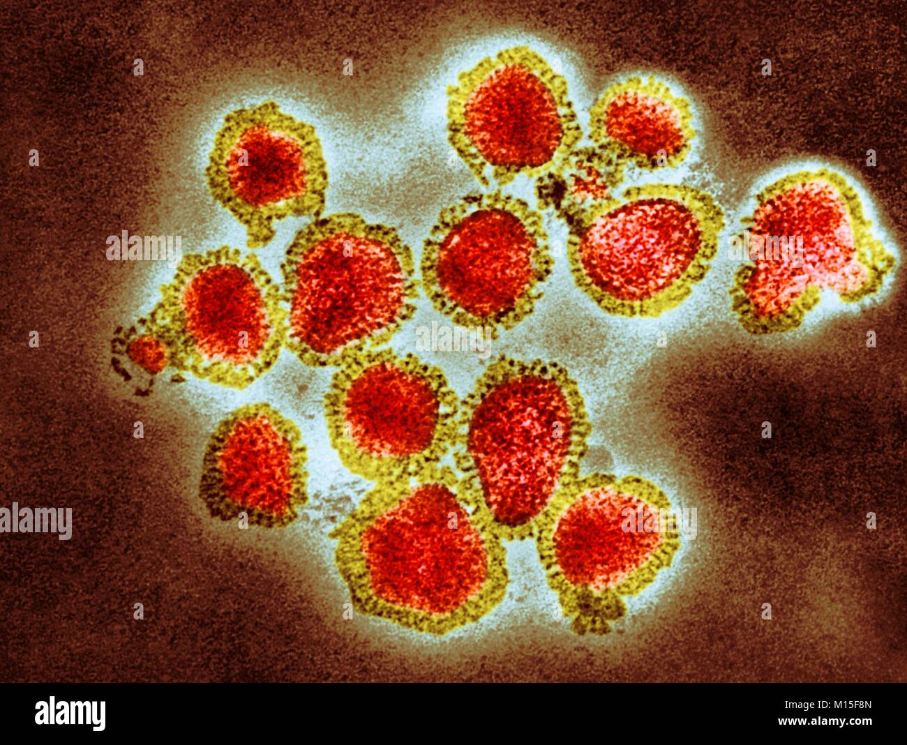 H3N2 influenza virus particles, coloured transmission electron micrograph (TEM). Each virus consists of a nucleocapsid (protein coat) that surrounds a core of RNA (ribonucleic acid) genetic material. Surrounding the nucleocapsid is a lipid envelope that contains the glycoprotein spikes haemagglutinin (H) and neuraminidase (N). These viruses were part of the Hong Kong Flu pandemic of 1968-1969 that killed approximately one million worldwide. H3N2 viruses are able to infect birds and mammals as well as humans. Stock Photo