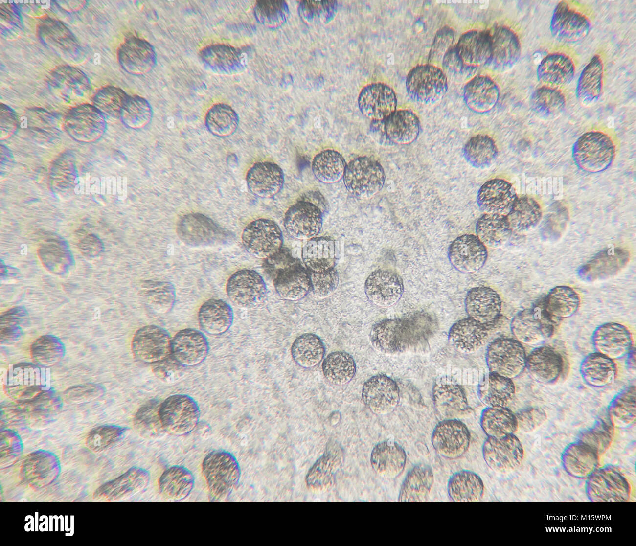 Chlamydomonas algae, paramecium ciliates and many bacteria through microscope Stock Photo