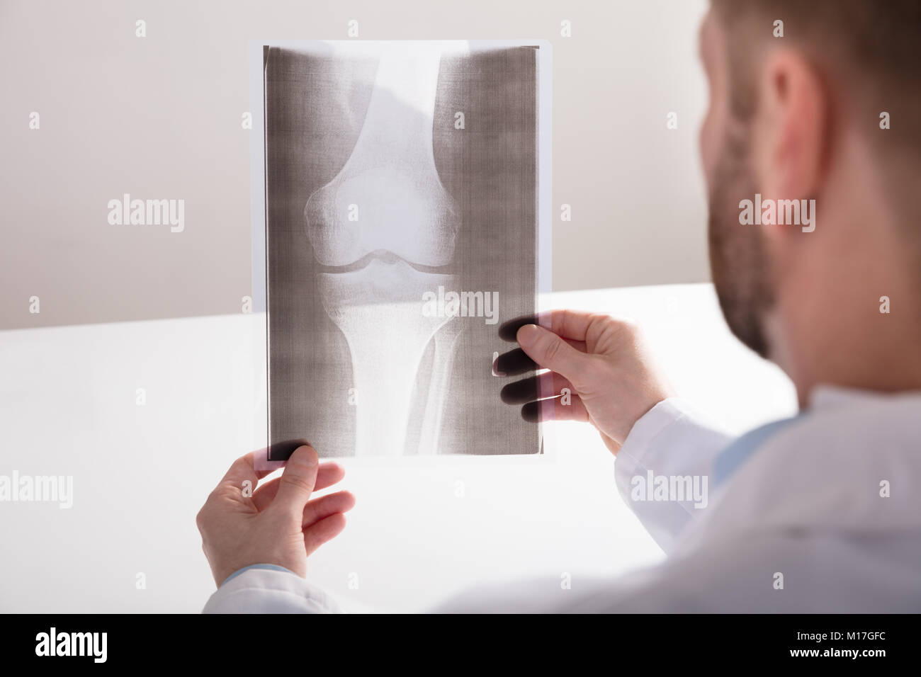 Close Up Of A Male Doctor S Hand Holding Knee X Ray Stock Photo Alamy