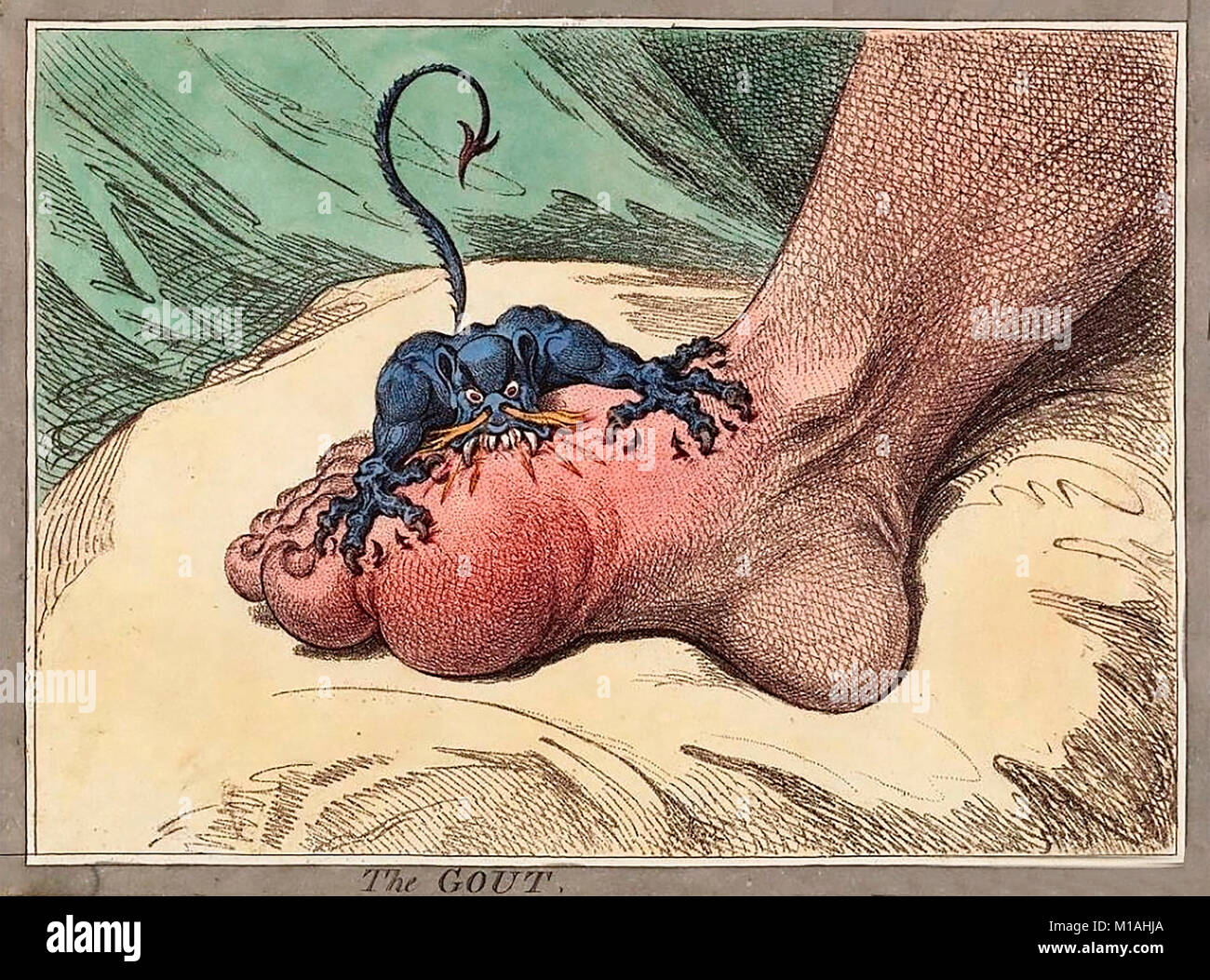 The Gout by James Gillray - Illustration showing the painful attack of gout Stock Photo