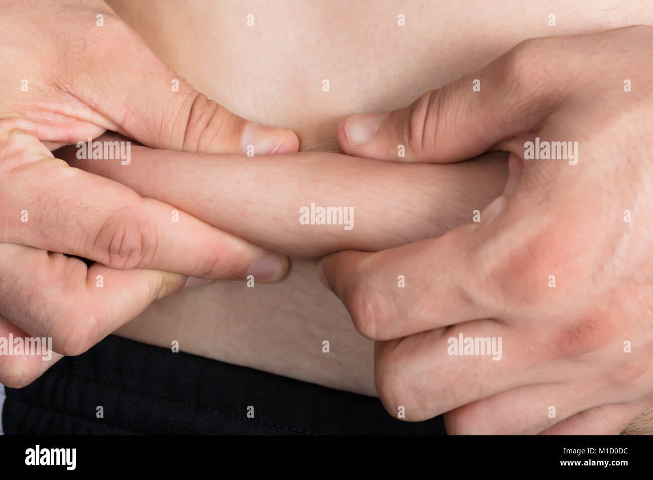 Close-up Of A Man's Hand Pinching Excessive Stomach Fat Stock Photo