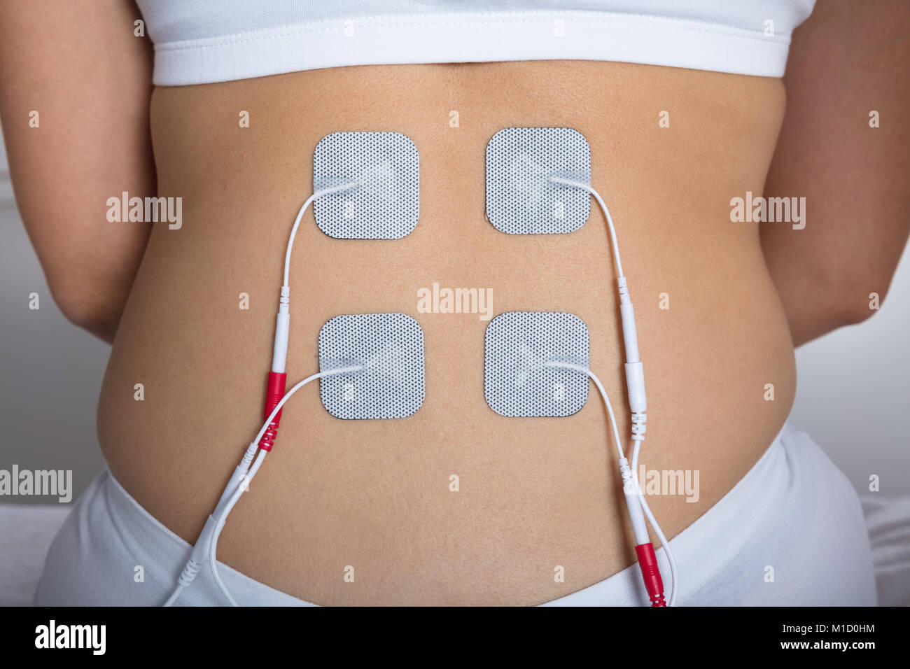 Close-up Of A Woman With Electrostimulator Electrodes On Her Back Stock Photo