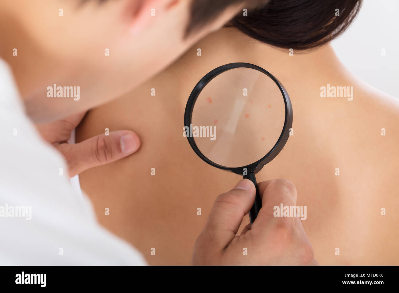 Doctor Checking Skin Of Patient With Magnifying Glass Stock Photo