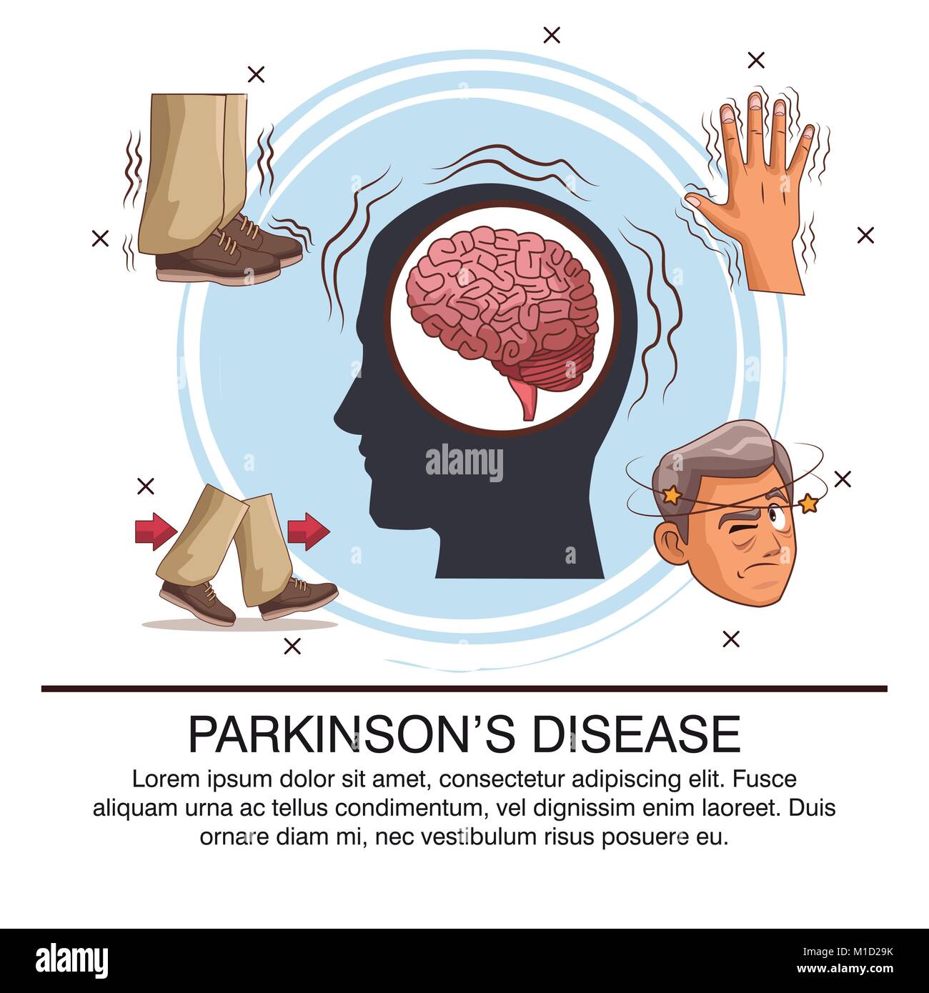 Parkinsons disease infographic Stock Vector Image Art Alamy Parkinsons disease infographic Stock Vector Image Art Alamy