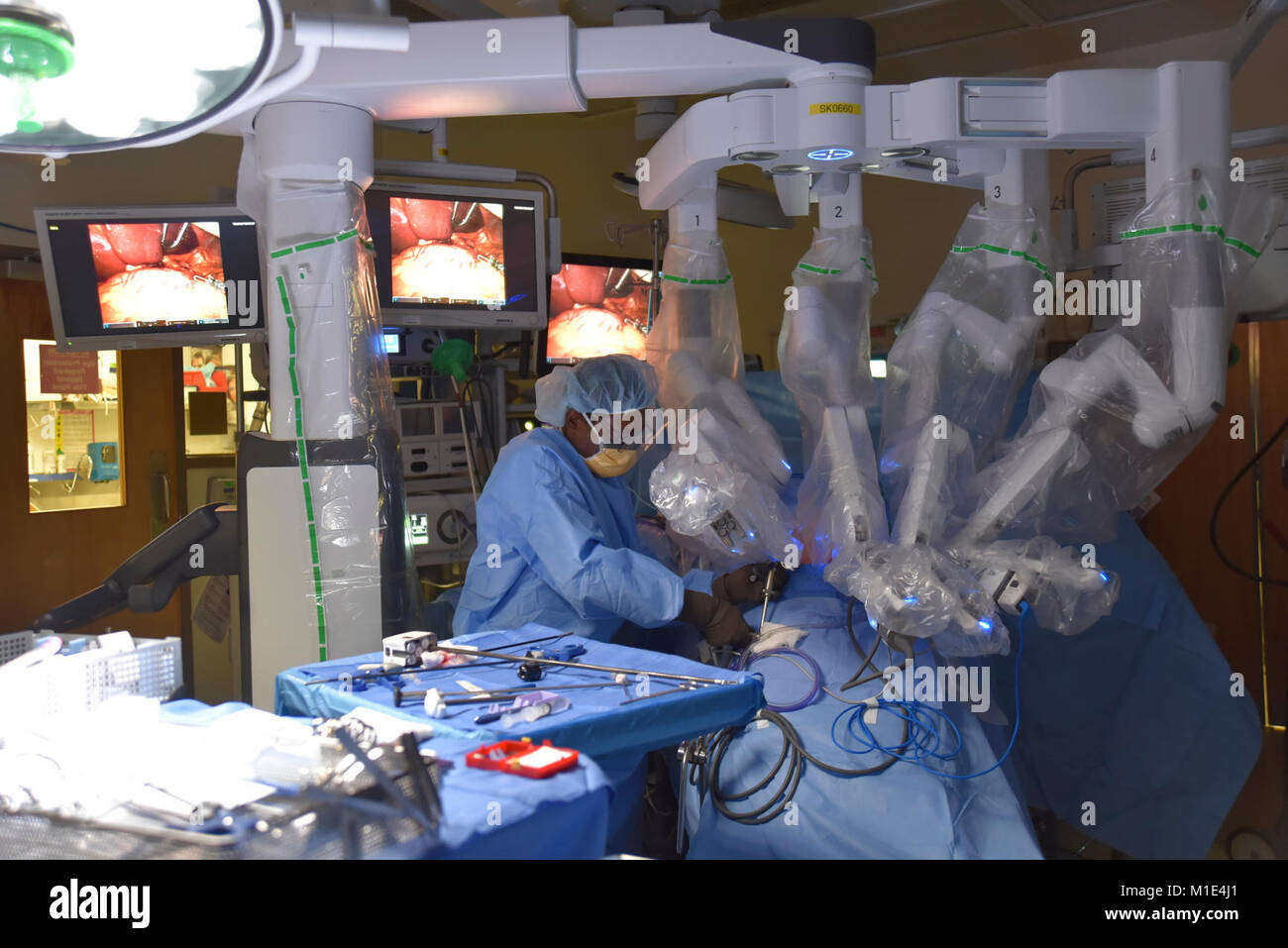 A robotic surgical system is inserted in the stomach through four