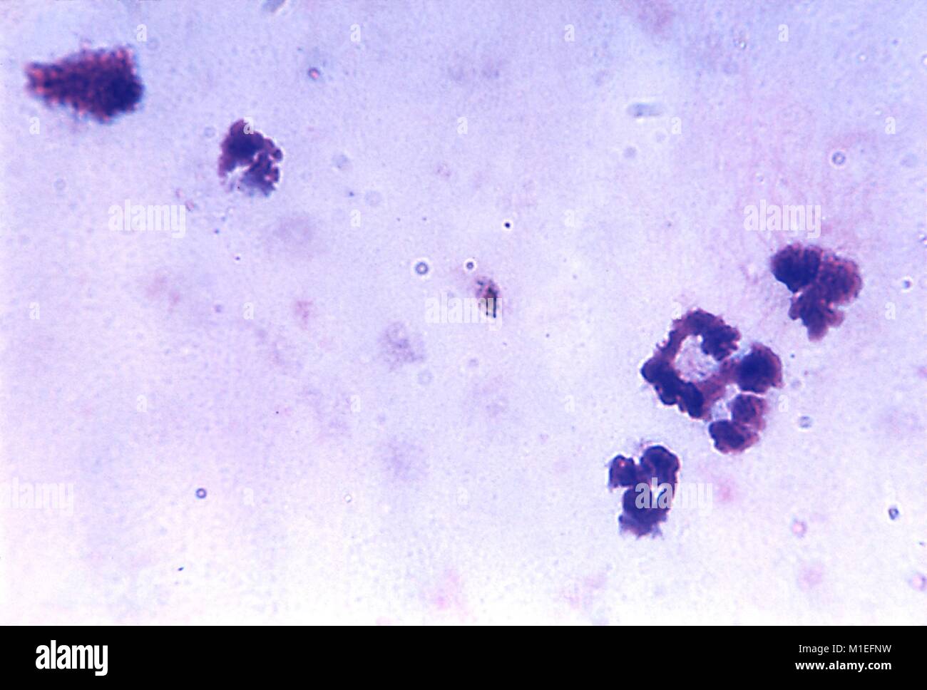 Plasmodium falciparum gametocyte revealed in a blood smear photomicrograph, 1963. Image courtesy Centers for Disease Control (CDC) / N J. Wheeler, Jr. () Stock Photo