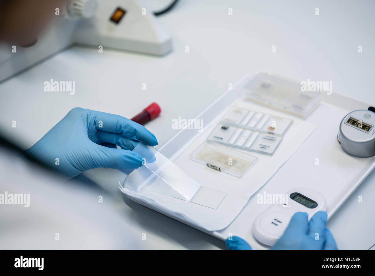 Close up of lab technician preparing blood test Stock Photo