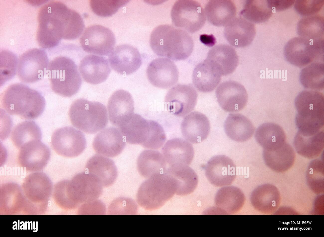 Plasmodium vivax ring form revealed in a blood smear micrograph film, 1970. Image courtesy Centers for Disease Control (CDC). () Stock Photo