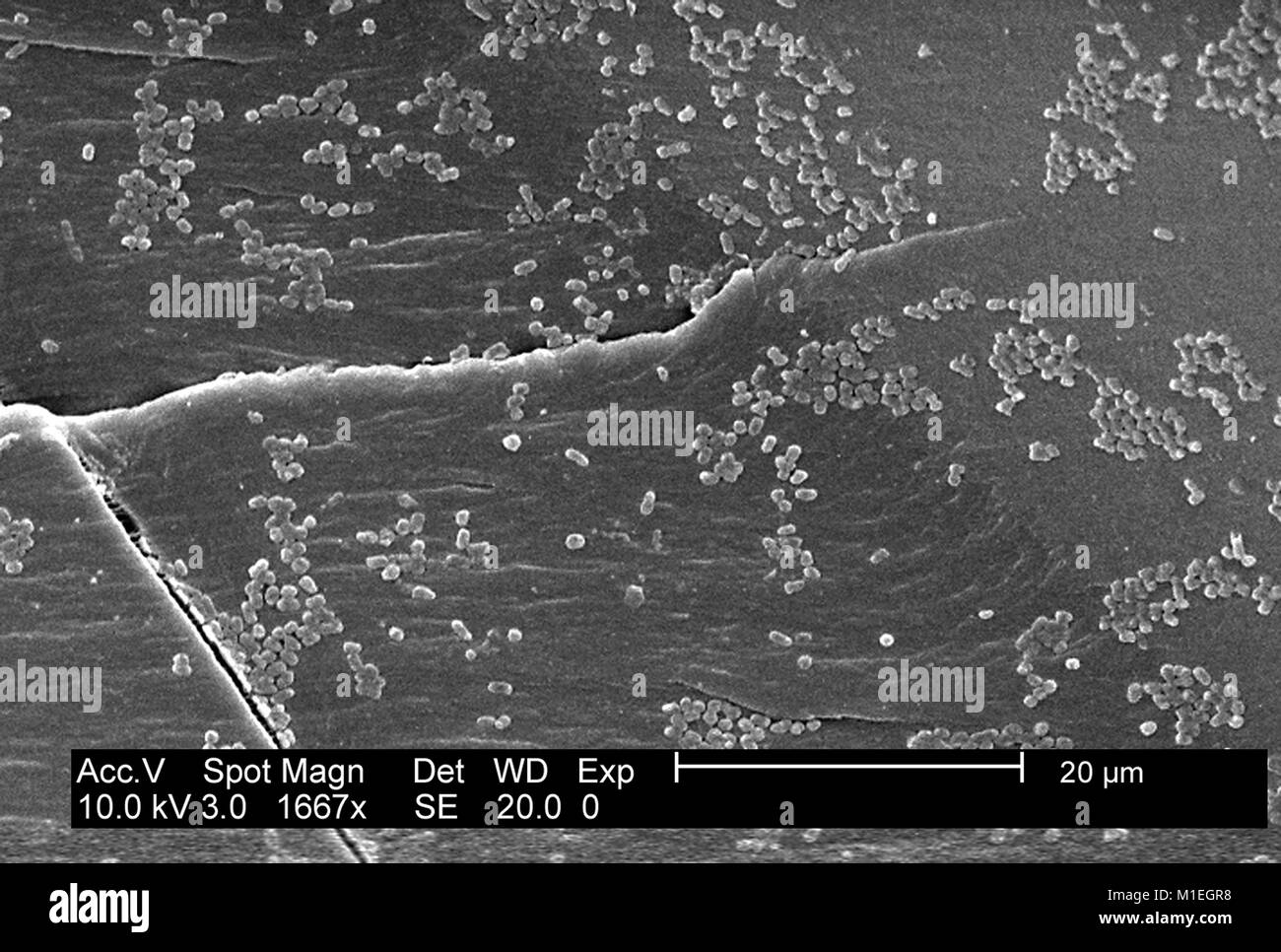 Biofilm growth hi-res stock photography and images - Alamy