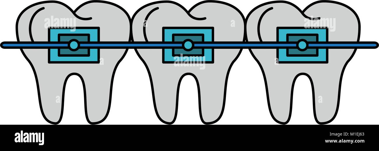 Teeths with brackets Stock Vector Image & Art - Alamy