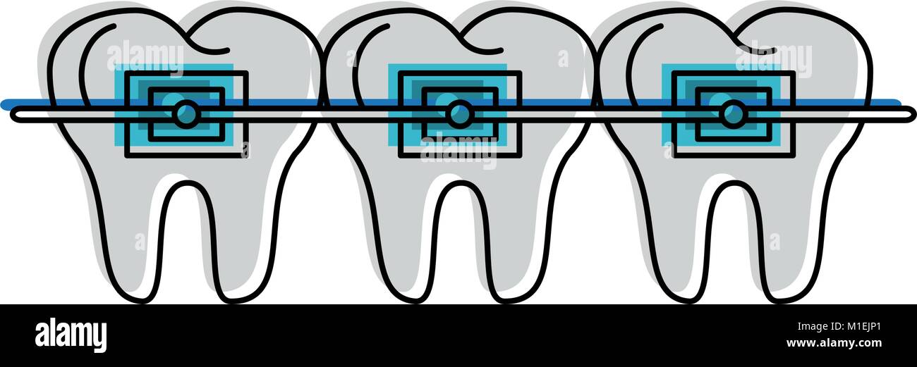 Orthodontic brackets Stock Vector Images Alamy